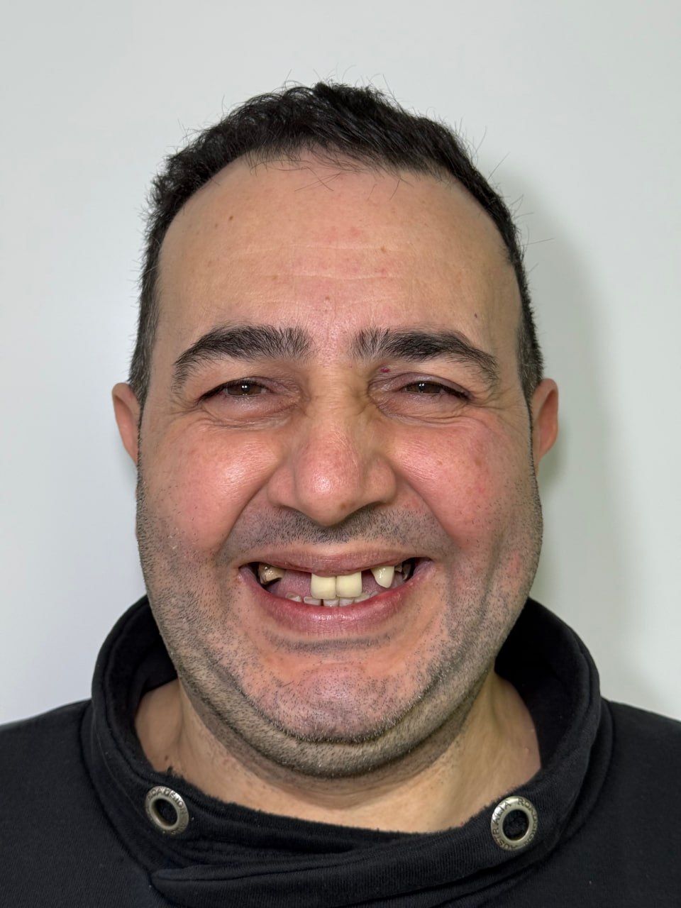 Vorher – Patient 2