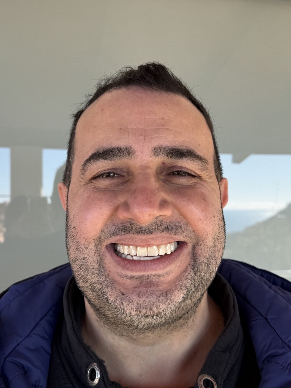 Nachher – Patient 2