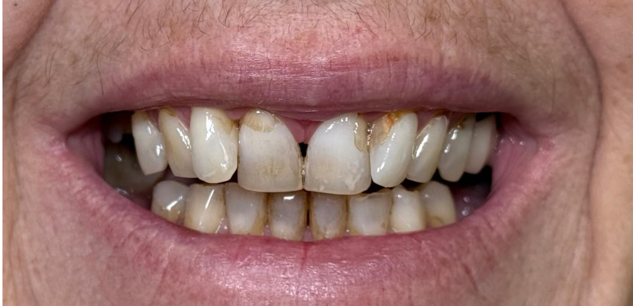 Vorher – Patient 3